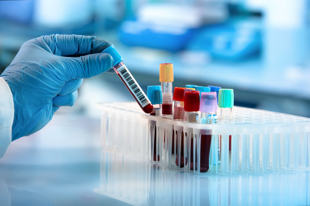 Lab_Test_Utilization_Urgent_Care_Analysis_Chart Chart depicting the frequency and median values of various lab tests in urgent care settings, including strep, influenza, and COVID-19 testing.